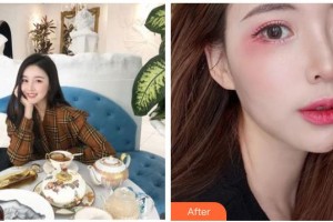 南充嬌美傾城醫(yī)學美容門診部張偉整形價格表附眼部綜合案例展示