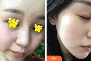 南充五星美容整形門診部楊建國整形價格表附激光美膚激光案例展示