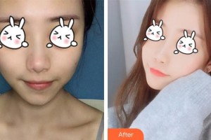 南充潤禾皮膚病專科醫(yī)院邱坤整形價(jià)格表附光子嫩膚案例展示