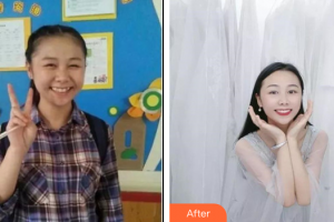 深圳德道口腔門診部李加亮整形價(jià)格表附牙齒矯正案例展示