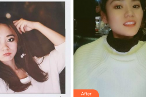 深圳童美口腔門診部田云整形價格表附瓷貼面案例展示