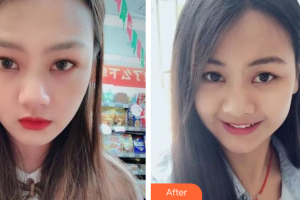 深圳德貝美口腔門診部焦偉波整形價格表附牙齒隱形矯正案例展示