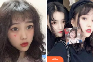 深圳正夫口腔門診部嚴寧整形價格表附牙齒隱形矯正案例展示