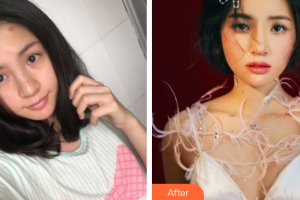 深圳纖韻醫(yī)療美容門診部鐘學行整形價格表附鼻部手術案例展示