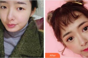 宜賓曼薇醫(yī)學(xué)整形醫(yī)院鄭祥兵整形價(jià)格表附眼部綜合案例展示