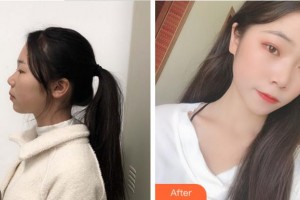 宜賓華膚皮膚病醫(yī)院何學(xué)敏整形價(jià)格表附光子嫩膚案例展示