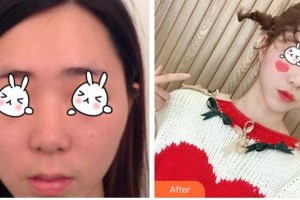 湖南省第二人民醫(yī)院整形美容中心倪若鳴整形價格表附光子嫩膚案例展示