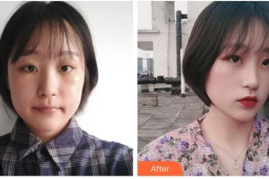 湖南博雅眼科醫(yī)院王鈾整形價格表附眼部整形案例展示