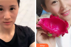 深圳口腔診所吳健雄整形價格表附冷光美白案例展示