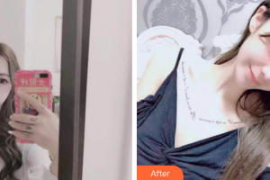 珠海拜博口腔醫(yī)院程旭整形價格表附時代天使矯正案例展示