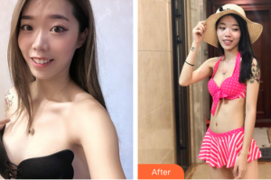 佛山壹加壹瑪麗婭整形美容醫(yī)院郝冬整形價格表附自體脂肪隆胸案例展示