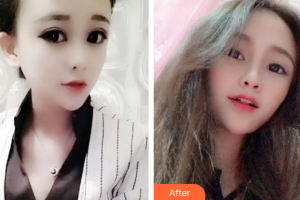 佛山壹加壹瑪麗婭整形美容醫(yī)院許凡平整形價格表附皓齒美白案例展示