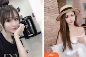 佛山黛顏人醫(yī)療美容門診部黃吉波整形價格表附鼻部手術(shù)案例展示