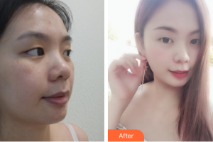 湛江市第一中醫(yī)院整形美容中心萬敏整形價(jià)格表附無針?biāo)獍咐故?>
</a>
<h3 class=