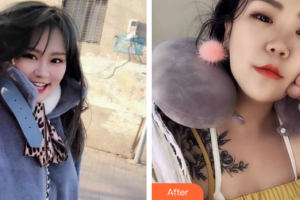 湛江東盟整形美容醫(yī)院林希瞳整形價(jià)格表附水氧活膚案例展示