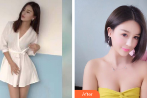 茂名華美整形美容醫(yī)院付炳根整形價格表附自體脂肪隆胸案例展示