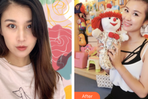 肇慶民和醫(yī)院激光整形科劉雙濤整形價格表附熱瑪吉案例展示