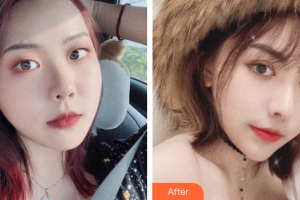 東莞中韓醫(yī)療美容診所喬松整形價(jià)格表附眼部綜合案例展示