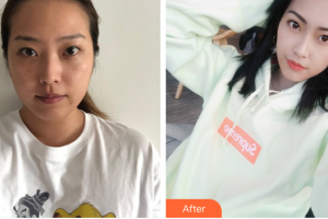 東莞市人民醫(yī)院醫(yī)學(xué)美容科陳曉武整形價(jià)格表附祛斑祛痣案例展示