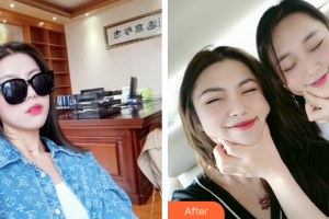 東莞韓美整形醫(yī)院樸正淳整形價(jià)格表附水光補(bǔ)水案例展示