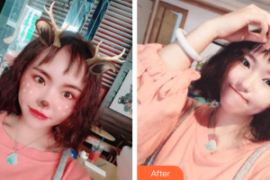 東莞瑞芙臣醫(yī)療美容門診部ColetteC整形價(jià)格表附超微小氣泡案例展示