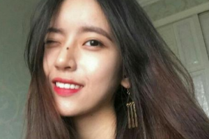 武漢科技大學(xué)附屬天佑醫(yī)院整形美容科陳芳整形價(jià)格表附光子嫩膚案例展示