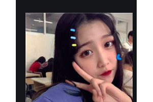 武漢伽美醫(yī)療美容醫(yī)院林孟羲整形價格表附耳軟骨復合隆鼻案例展示