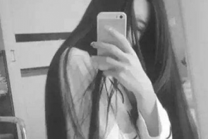 廣東藥學院附屬第一醫(yī)院激光整形美容外科惠俐整形價格表附紅藍光祛痘案例展示