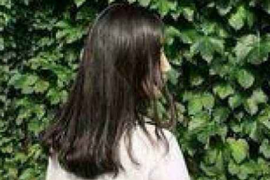 長春醫(yī)美整形美容醫(yī)院樸原辰整形價格表附埋線提升案例展示