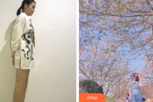 河南整形美容醫(yī)院王合珍整形價格表附大腿吸脂案例展示