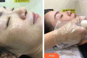 湖北武警總隊醫(yī)院醫(yī)學美容中心謝艾玲整形價格表附補水保濕案例展示