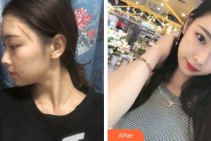 海南整形美容醫(yī)院馬文熙教授，整形價(jià)格表附皮膚美容案例展示