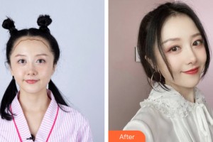 海南夢(mèng)妮幻整形?？崎T診部費(fèi)艷麗整形價(jià)格表附植發(fā)案例展示