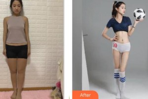 云南瑪麗亞整形美容醫(yī)院馮小良整形價(jià)格表附吸脂案例展示