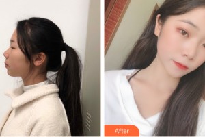 海南省皮膚病醫(yī)院激光整形美容中心劉巧整形價(jià)格表附皮膚美容案例展示