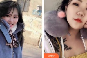 云南華美美萊美容醫(yī)院鄒慶整形價(jià)格表附水氧活膚案例展示