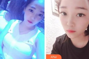 云南高原皮膚病醫(yī)院張順武整形價(jià)格表附白瓷娃娃案例展示