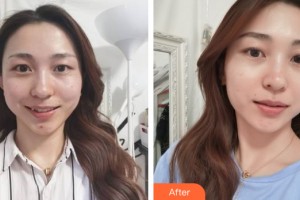 海南省皮膚病醫(yī)院激光整形美容中心焦仕程整形價格表附皮膚美容案例展示