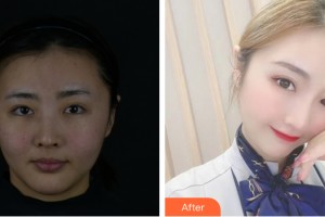 海南瑞韓醫(yī)學(xué)美容醫(yī)院王旋整形價(jià)格表附皮膚美容案例展示