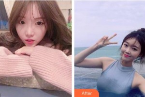 昆明天倫婦產(chǎn)醫(yī)院醫(yī)學(xué)整形美容中心米娜主診醫(yī)師整形價格表附鼻部綜合案例展示