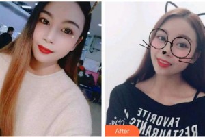 昆明超然醫(yī)學(xué)整形美容外科醫(yī)院申晶整形價格表附牙貼面案例展示