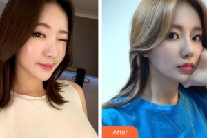 昆明前衛(wèi)美眼整形?？圃\所馮曉明整形價格表附鼻部綜合案例展示