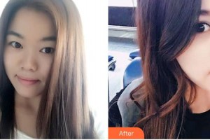 整形醫(yī)院尹海榮整形價格表附鼻部綜合案例展示