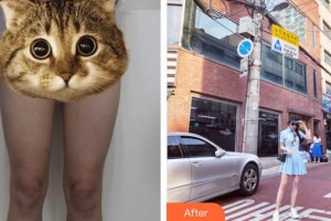 昆明都市儷人美容醫(yī)院葉根生整形價格表附吸脂案例展示