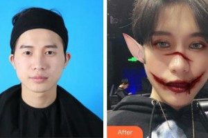 昆明美立方（原大華）醫(yī)療美容醫(yī)院辛杰整形價格表附眼部綜合案例展示