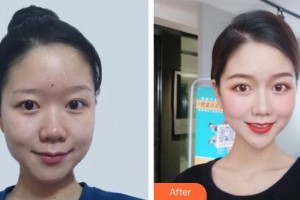 昆明皮膚病?？漆t(yī)院黃文標整形價格表附激光祛斑案例展示