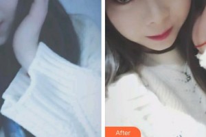 昆明皮膚病?？漆t(yī)院王正文整形價(jià)格表附眼部綜合案例展示