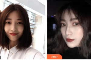 昆明愛爾眼科醫(yī)院孫鵬整形價(jià)格表附眼部綜合案例展示