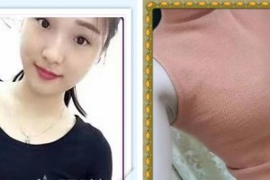 揚(yáng)州施爾美醫(yī)療美容醫(yī)院冷永成整形價格表附自體脂肪隆胸案例展示