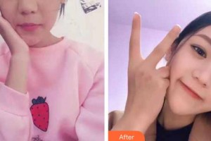 昆明眼科醫(yī)院馮雁整形價格表附定點雙眼皮案例展示